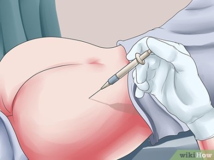 Cum să preveniți și să tratați sângerările postpartum