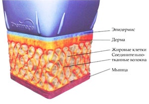 Cum sa alegi cel mai bun aparat pentru termolifiere