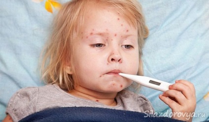 Cum de a vindeca o alergie la un copil la domiciliu - portal medical de pe teritoriul Primorye