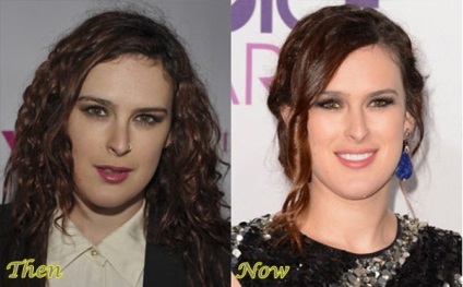 Cine este Rumer Willis cariera, viata personala, a facut plasticul, inainte si dupa plastic