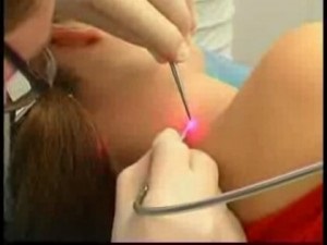 Tratamentul cu laser în dermatologie, clinica de medicină laser în Kiev