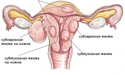 Modificări lunare în ciclul meu menstrual