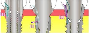 Mituri despre con, implantarium