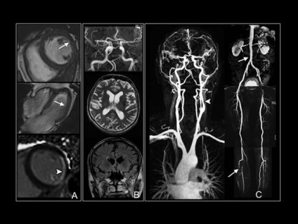 Prețul arterelor și venelor coloanei cervicale cu contrast,