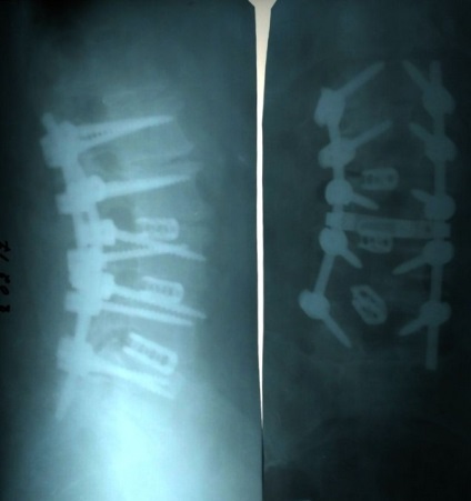 Neurochirurgul Andrew Garus efectuează operații complexe asupra creierului pentru copii și adulți, postul chernihiv