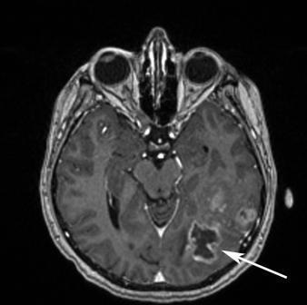 Neurochirurgul de semințe maxime sergeevich