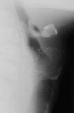 Nold - numărul 1-2, 2002 - diagnosticul de radiații al bolilor laringelui