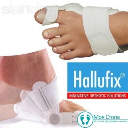 Hallufix ortopedic valgus anvelope recenzii și sfaturi de utilizare
