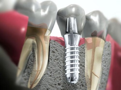 Ortopédia - dia-dent - fogászat a Kirov 7 (8332) 776-026; 71-40-31