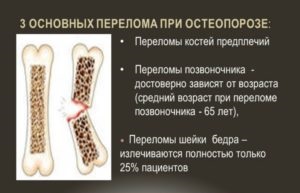 Csontritkulás a törések és kezelés törési kockázata után