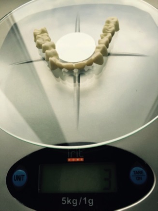 Gyakorlati tapasztalat trínia anyag felhasználására a protetikában a létfontosságú és devital fogakon