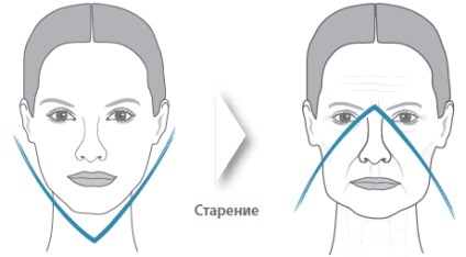 Radiesse (radium) este un medicament pentru ridicarea non-chirurgicală și pentru stimularea producerii colagenului (medicamentului) Radiesse (radium) este un medicament pentru ridicarea și stimularea non-chirurgicală a producției de colagen pe