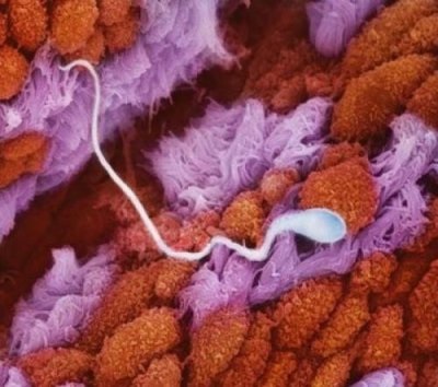 A spermiumok kifejlesztése