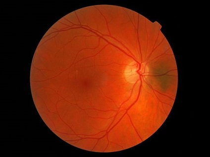 Az orosz tudósok a szeme retináját a bőrsejtekből - a tudományból nőtték fel