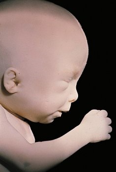 Mișcările fetale, prima învârtire a fătului, cea de-a doua sarcină, amestecarea fetală, frecventă