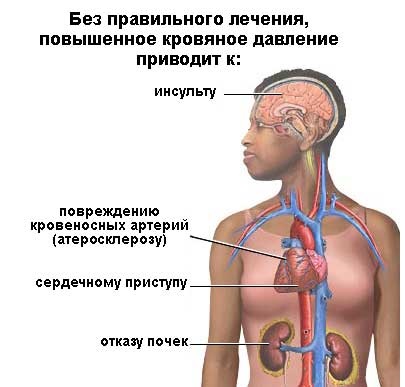 Sfaturi pentru hipertensiune