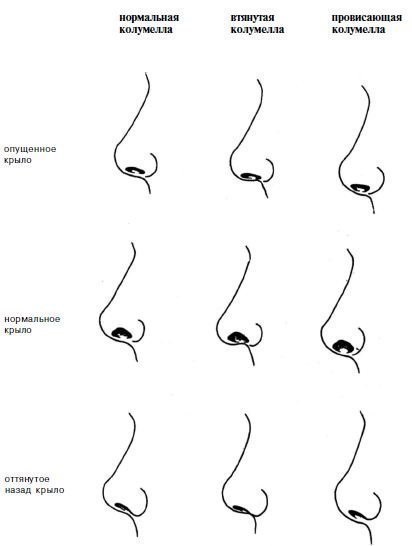 Complicații specifice în vârful nasului