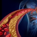 Metodele de curățare a intestinelor sunt simple și eficiente