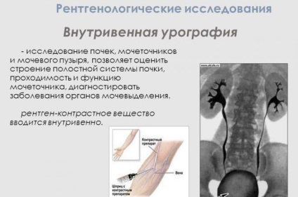 Scintigrafia glandei tiroide - ceea ce este, efectele secundare, cum să procedați