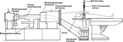 Tipuri de instalatii CT, tomografie computerizata