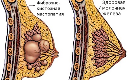 Uzi de glande mamare care arată