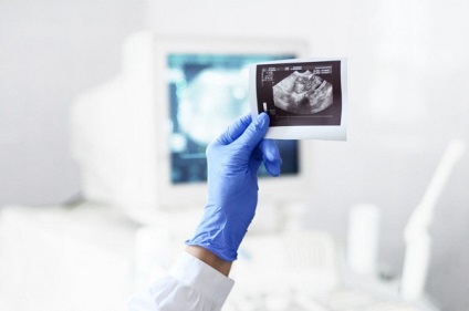Heart ultrasunete în Borisov și Zhodino - prețurile pentru diagnosticul ultrasonografic al inimii