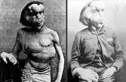 10 Cele mai abominabile boli umane