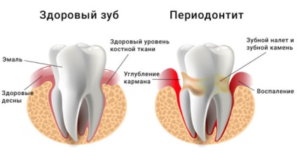 Amoxiclav efecte secundare și indicații pentru utilizare la copii și adulți