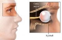 Atrofia nervului optic, oftalmologie