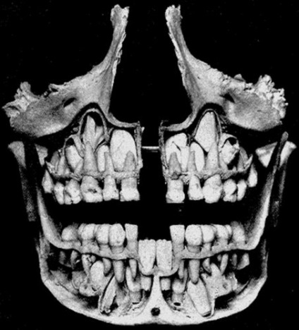 Craniul unui copil înainte de dentiție