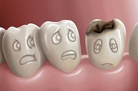 Ce este degradarea dinților și cum să scapi de ea la adulți și copii
