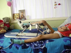 Az endoprotetikumok a csontdaganatokban, az Orosz Gyermekklinikai Kórházban