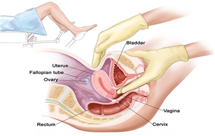 Masaj ginecologic cu miom uterin - academia de sănătate a femeilor