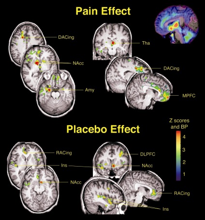 Красив ум, плацебо ефект