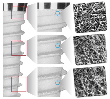 Sistemul de implantare snukon (snucone)