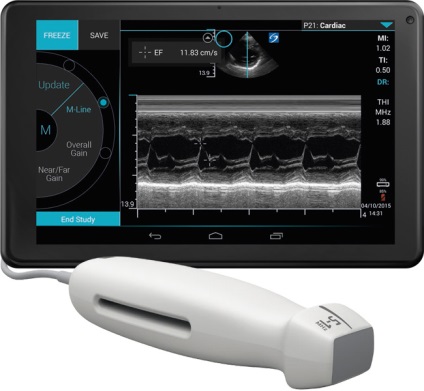 Iviz - scaner cu ultrasunete flatbed de la fujifilm sonosite