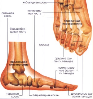 Як виправити плоскостопість