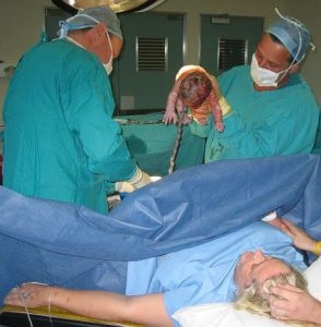 Cesarean secțiunea - cum o astfel de operație și care sunt cauzele și consecințele comportamentului său