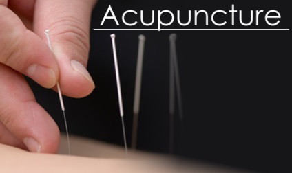 Acupunctura chineză (acupunctura) în epoca modernă