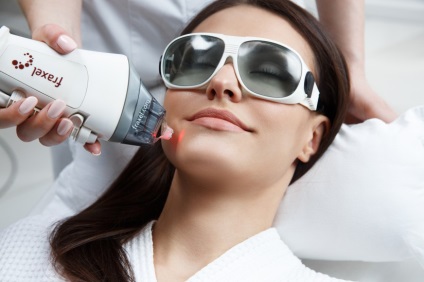 Peeling cu laser clar strălucitor, Novosibirsk