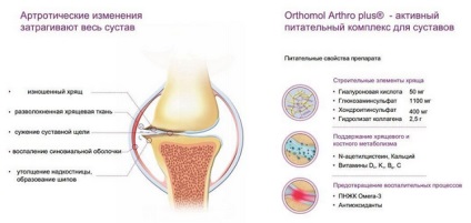 Orthomol Arthro plus (orthomol Arthro plus) instrucțiuni de utilizare, comentarii, pret