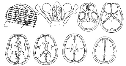 Principiile de bază ale tomografiei computerizate, tomografia computerizată