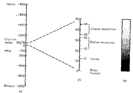 Principiile de bază ale tomografiei computerizate, tomografia computerizată