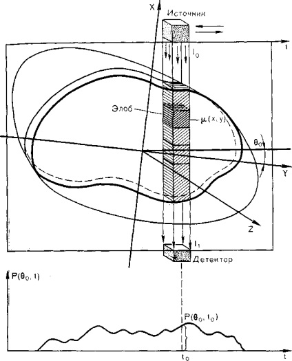 Principiile de bază ale tomografiei computerizate, tomografia computerizată