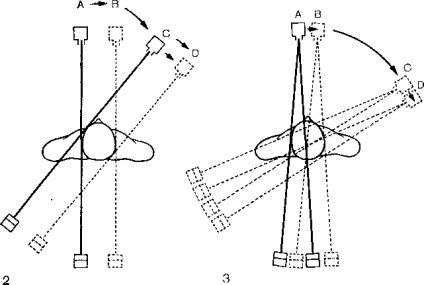 Principiile de bază ale tomografiei computerizate, tomografia computerizată