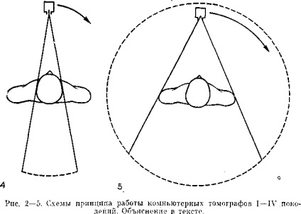 Principiile de bază ale tomografiei computerizate, tomografia computerizată