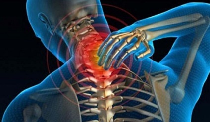A nyaki gerinc görbületének főbb tünetei és módszerei