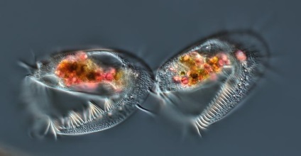 Parazita protozoa