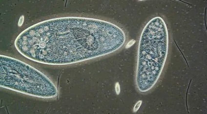 Parazita protozoa