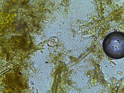 Protozoa parazitară